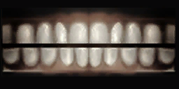 Teeth Teeth