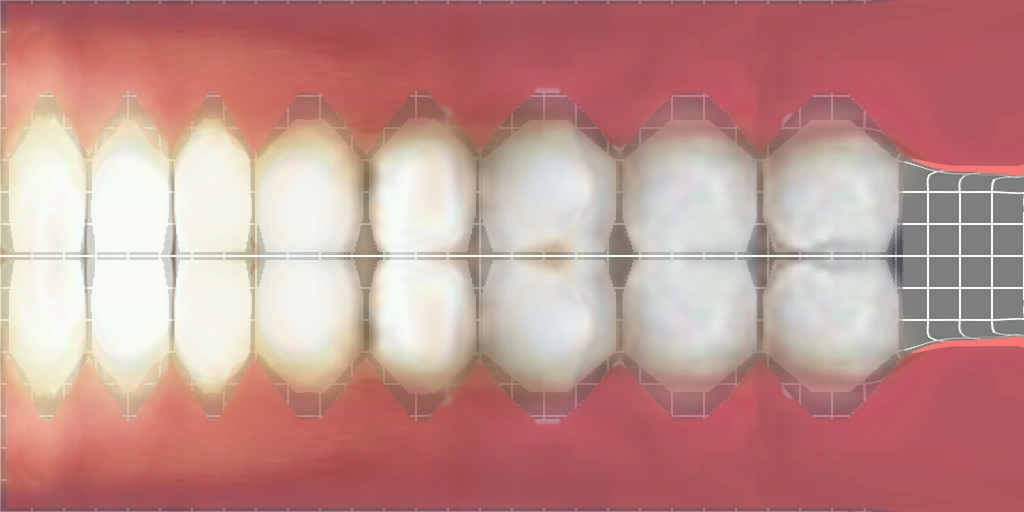 halflife2_chellteeth1.png halflife2_chellteeth1.png