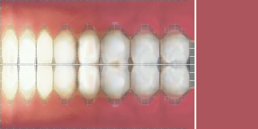 halflife2_chellteeth2.png halflife2_chellteeth2.png