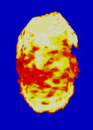 Sonic_The_Fighters_FireEffect2.png