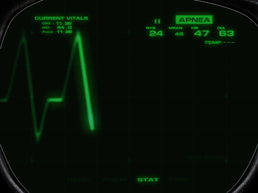 Part of the animated sequence that plays after the player has been dead for a few seconds.