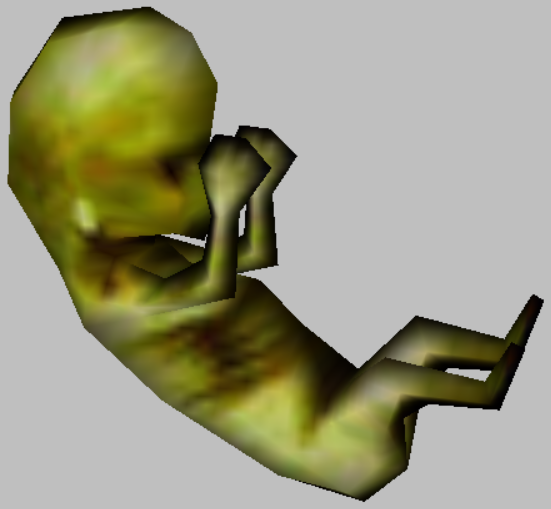 fetus fetus